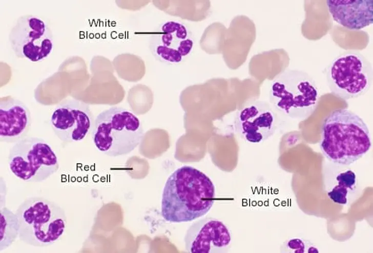 What's Happening in Your Blood?