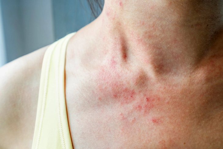 What Collagen Can’t Do