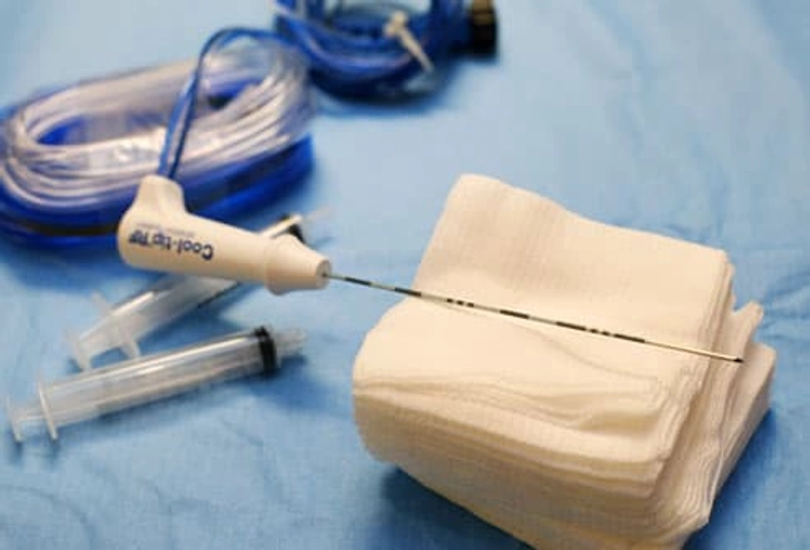 Radiofrequency Ablation (RFA)