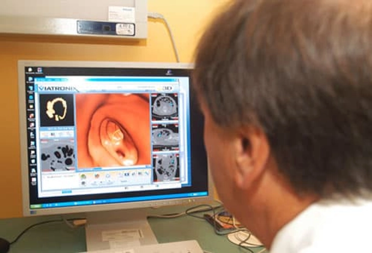 Virtual Colonoscopy