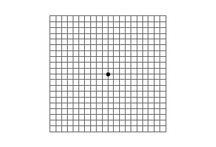 Macular Degeneration: Test