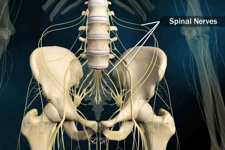 Cauda Equina Syndrome