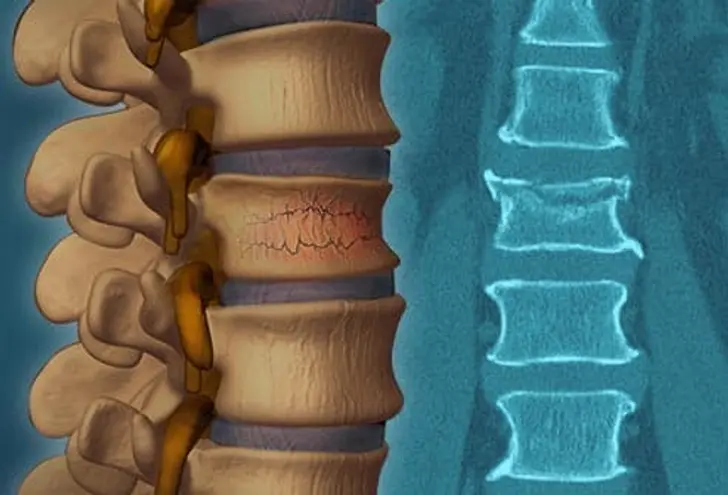 Do You Need Back Surgery? Do You Need Back Surgery?