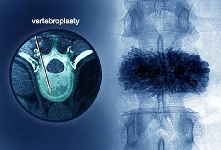 What Happens During Surgery What Happens During Surgery
