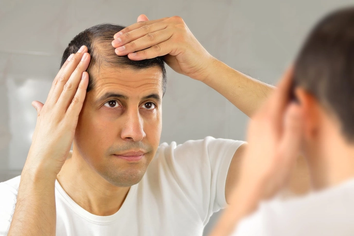 Hair Loss Hair Loss