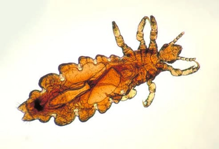 Lice
