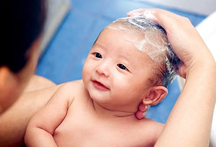 Treatment for Cradle Cap Treatment for Cradle Cap