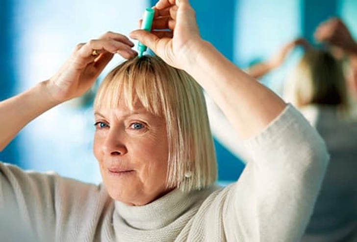 Treatment for Scalp Psoriasis Treatment for Scalp Psoriasis