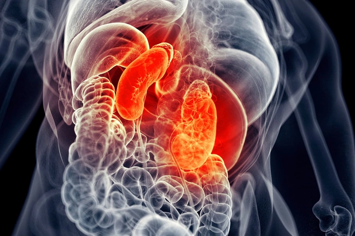 Kidney Inflammation Kidney Inflammation