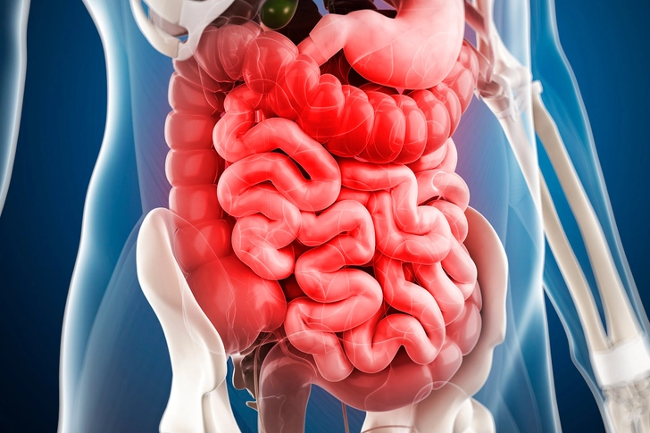 Irritable Bowel Syndrome (IBS)