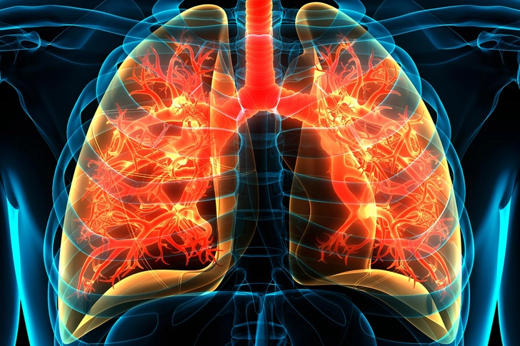 Lung Diseases