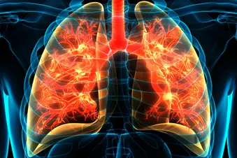 photo of lungs affected with copd