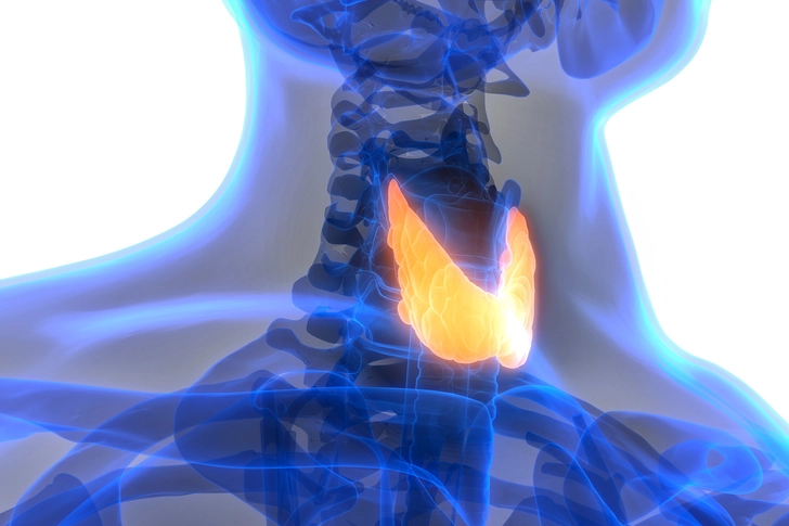 Hyperthyroidism Hyperthyroidism