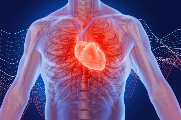 Heart Problems