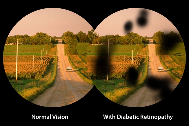You're Losing Your Sight