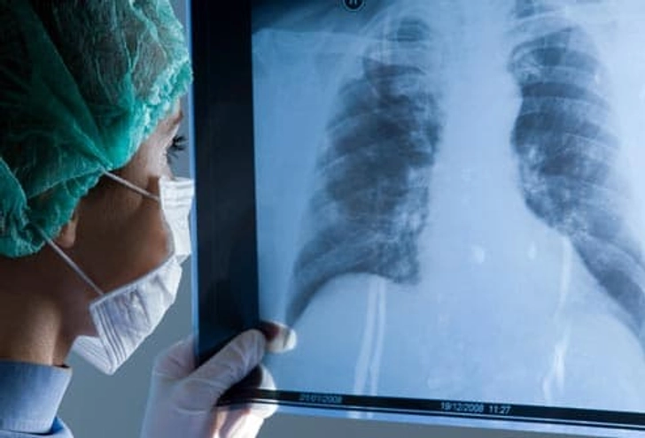 Treatment: Surgery Treatment: Surgery