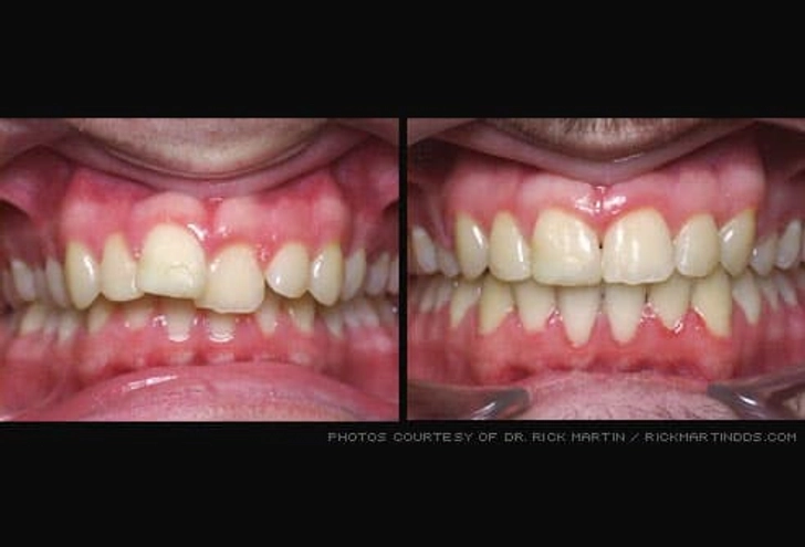 Orthodontics (Braces)