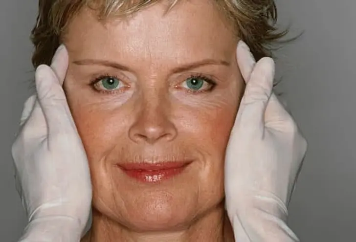 Cosmetic Surgery: Before and After