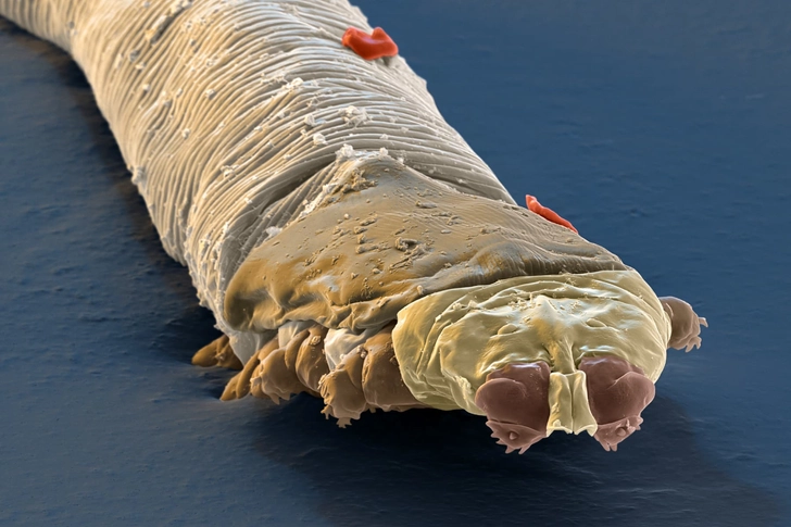 Face and Eye Mites Face and Eye Mites