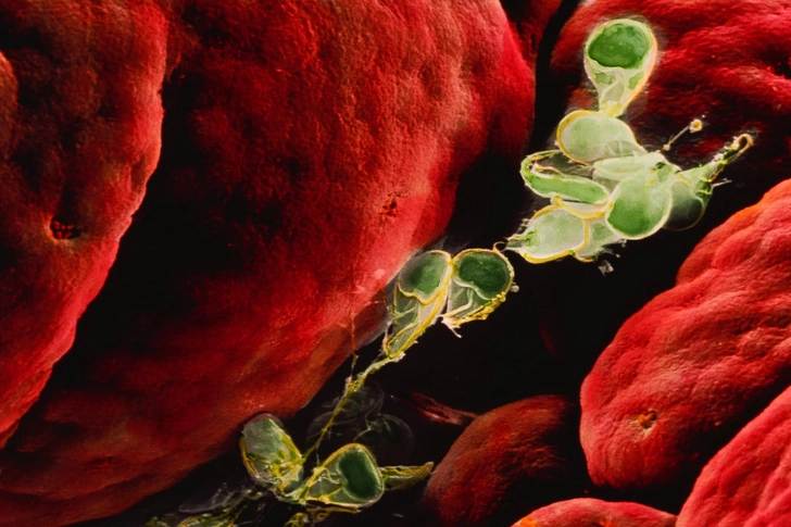 Giardia