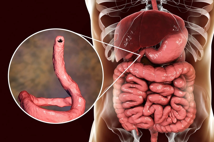 Hookworm