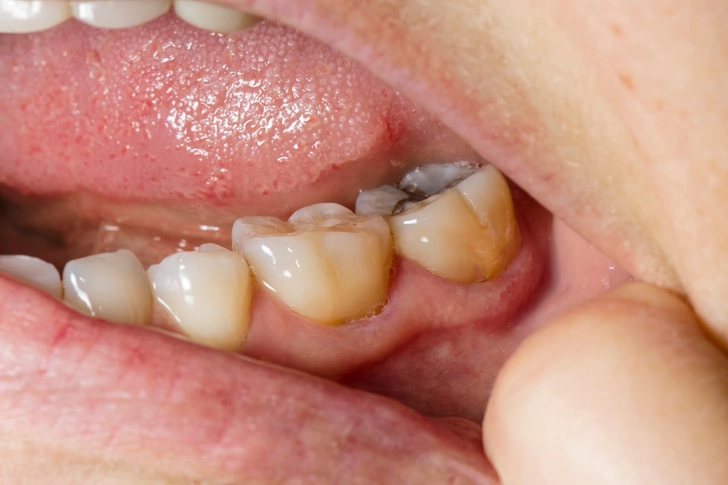 Mouth Creatures