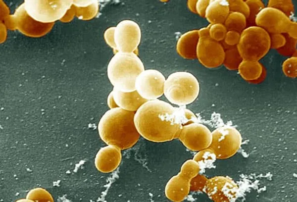 malassezia fungus