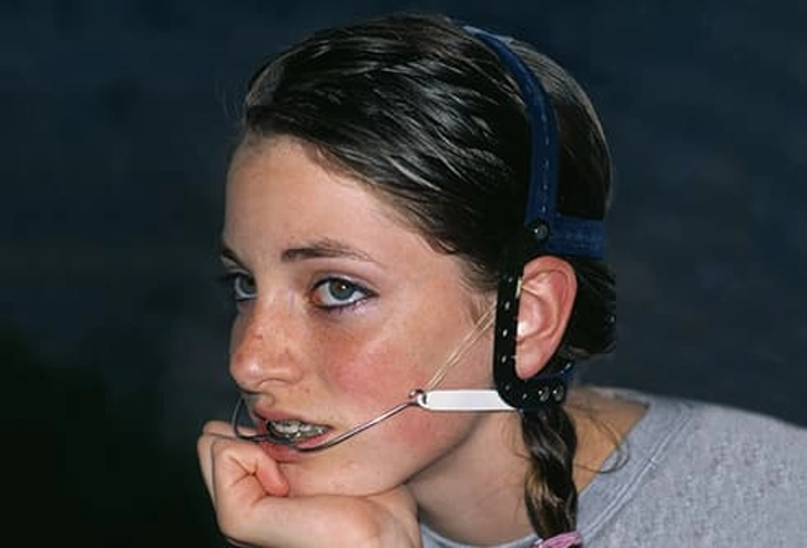 Headgear