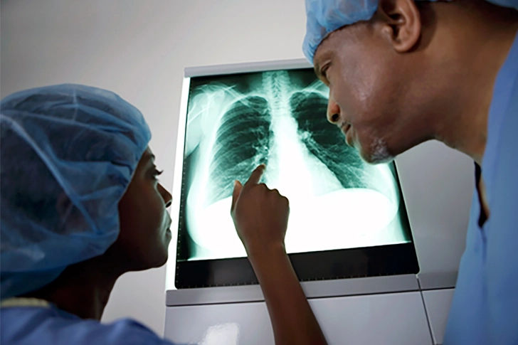Lung Surgery for COPD
