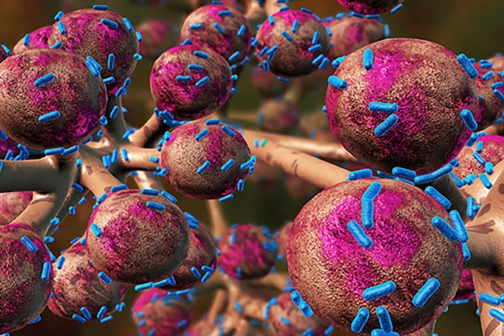 COPD Infections and Antibiotics