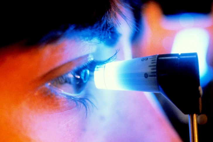 Glaucoma