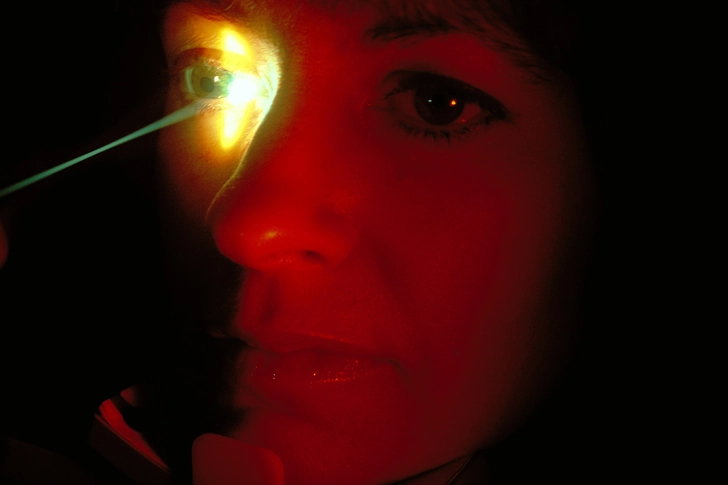 Laser Treatment