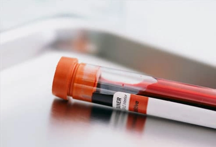 How Is It Diagnosed?