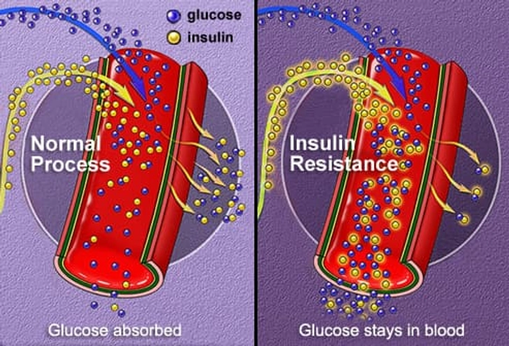 Metabolism Mishaps