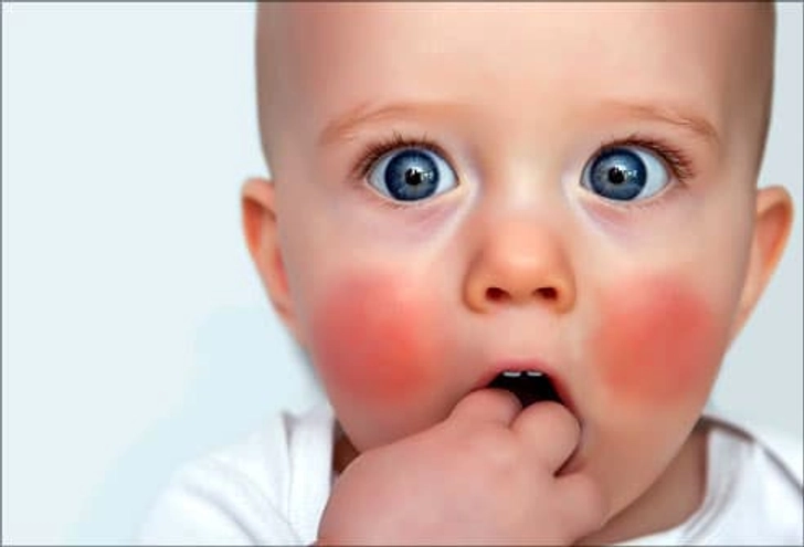 Teething Causes Diarrhea