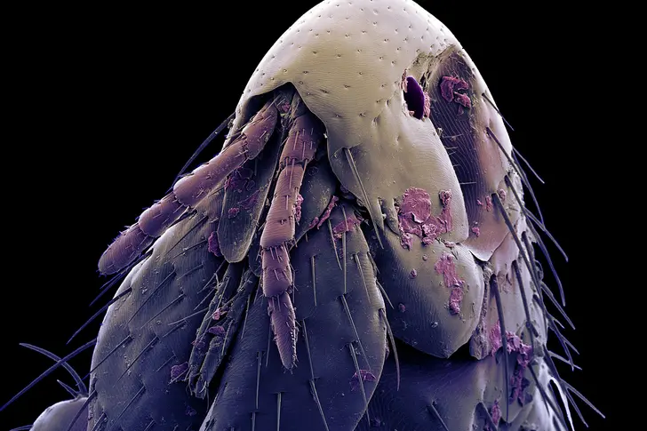 Plague Plague