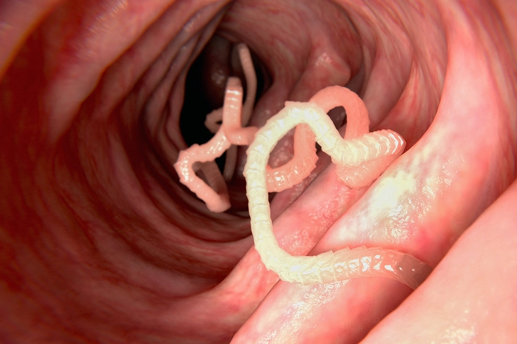 Tapeworm
