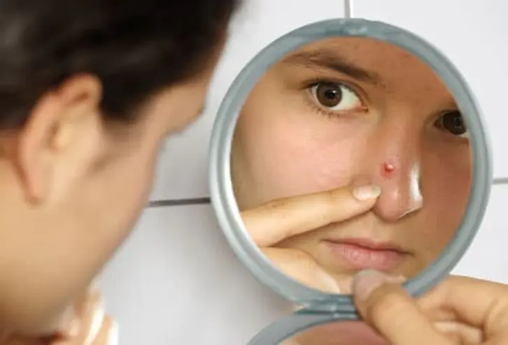 Monster Zit