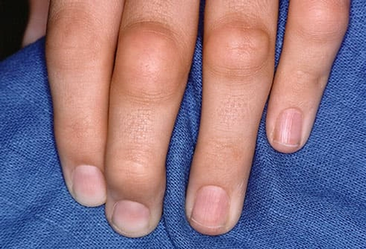 Possible Cause: Certain Illnesses Possible Cause: Certain Illnesses