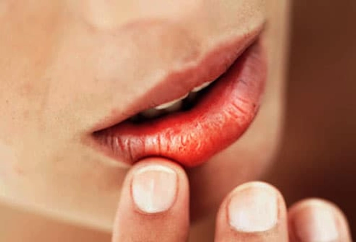 The Dry Mouth Feeling