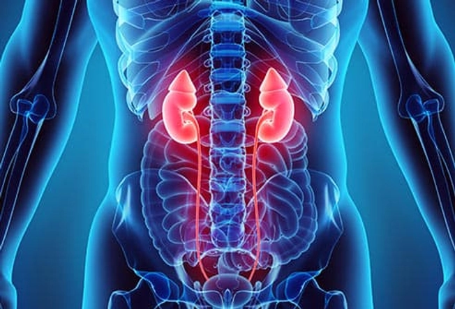 Location: Kidneys Location: Kidneys