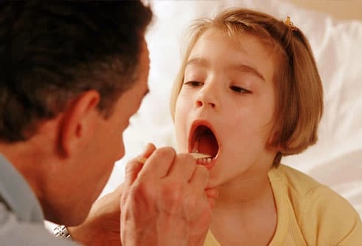 Tonsils Can Be the Cause