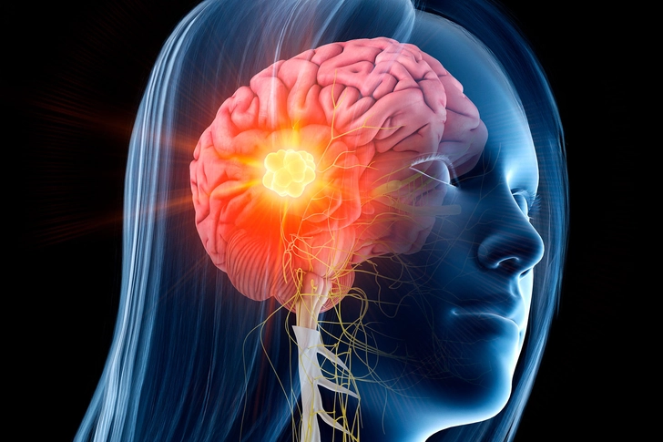 What Are Benign Primary Brain Tumors? What Are Benign Primary Brain Tumors?