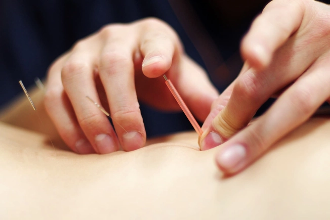 Try an Alternative Therapy Try an Alternative Therapy