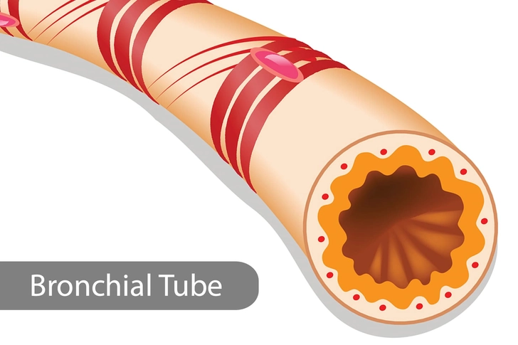 72 Hours: Bronchial Tubes 72 Hours: Bronchial Tubes