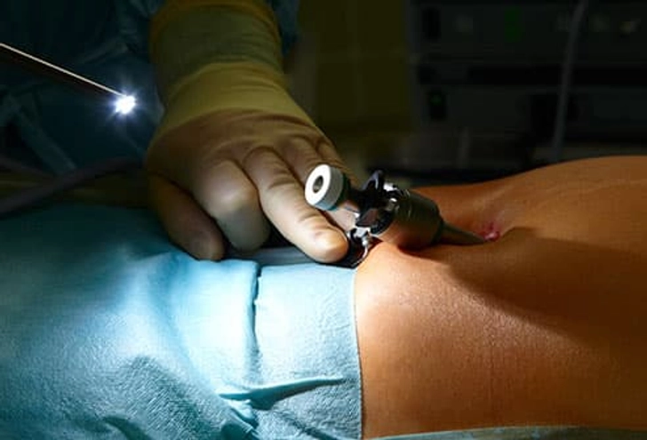 Diagnosis: Laparoscopy Diagnosis: Laparoscopy