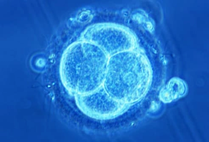 Endometriosis and Infertility Endometriosis and Infertility