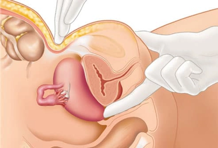 Diagnosis: Pelvic Exam Diagnosis: Pelvic Exam