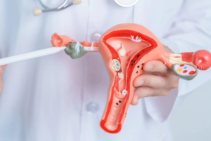 What Is a Hysterectomy?