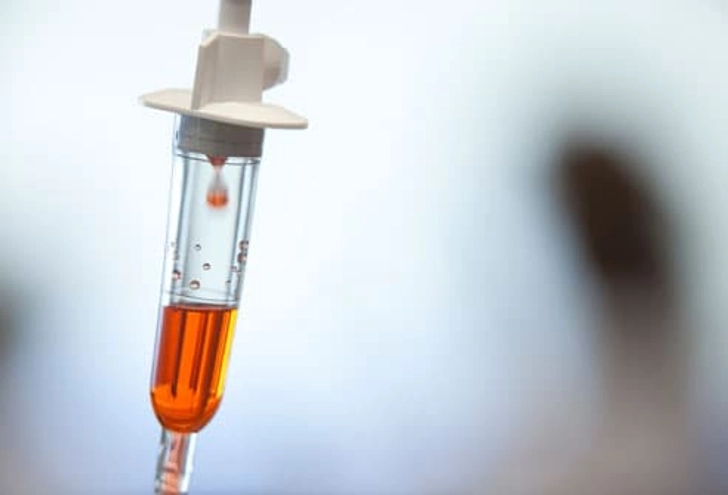 Treatment for Status Seizures